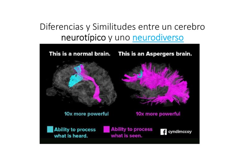 Cerebro Neurotípico Vs Cerebro Neurodiverso | PDF