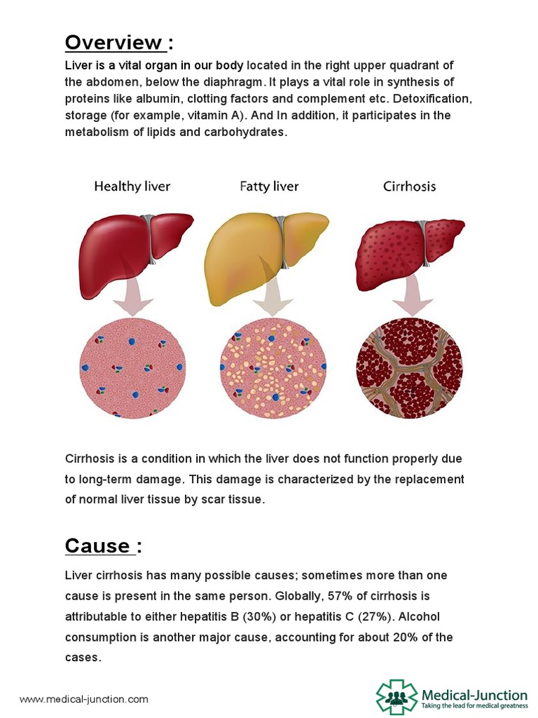 Liver Cirrhosis Pdf Cirrhosis Liver