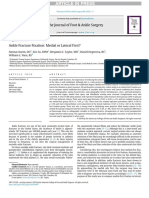 Ankle Fracture Fixation - Medial or Lateral First?