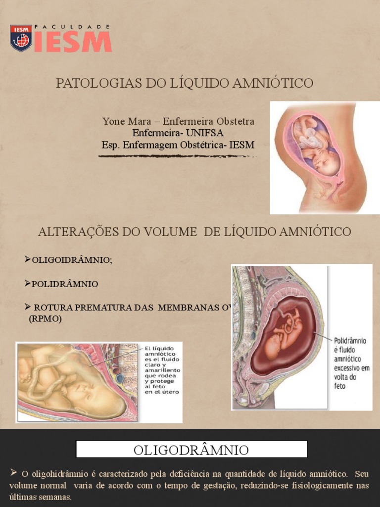 Patologias Do Liquido Amniótico | PDF | Gravidez | Parto
