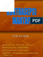 Kontrasepsi Mantap