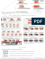 Tipos de Dolores de Cabeza - Buscar Con Google