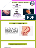 Placenta Previa y Aborto