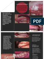 LEUCOPLASIA