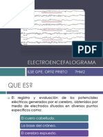 EEG: Electroencefalograma guía