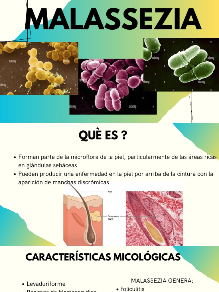 Malassezia PDF Enfermedades y trastornos Inmunología