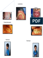 Fotos Intraorales 3