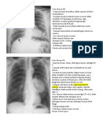 Latihan Thorax Radiologi