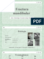 Fractura Mandibular