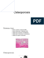 Clase Osteoporosis