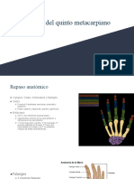 Fractura Del Metcarpo