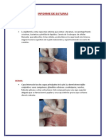 Informe Suturas