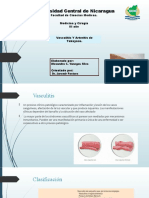 Vasculitis