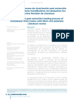 Impacto en El Proceso de Cicatrizacin Post Extraccin de Terceros Molares 1