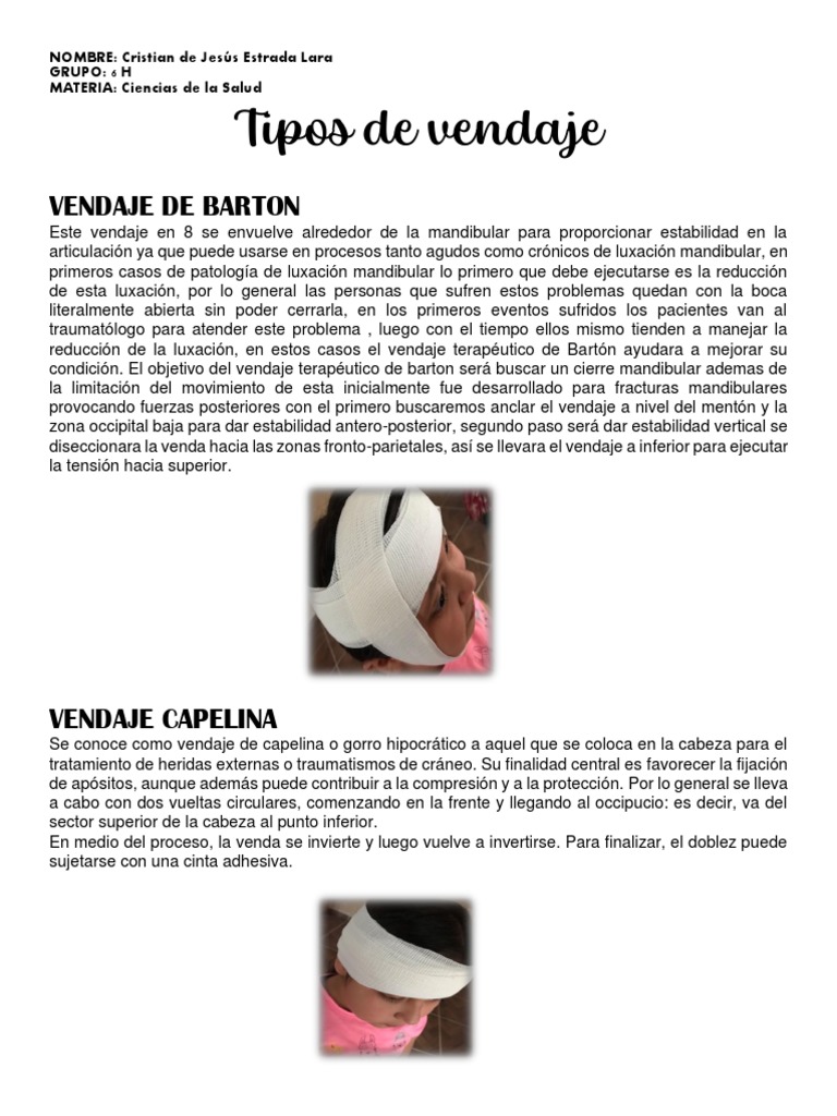 Vendajes de Capelina y Barton: Guía Práctica | PDF