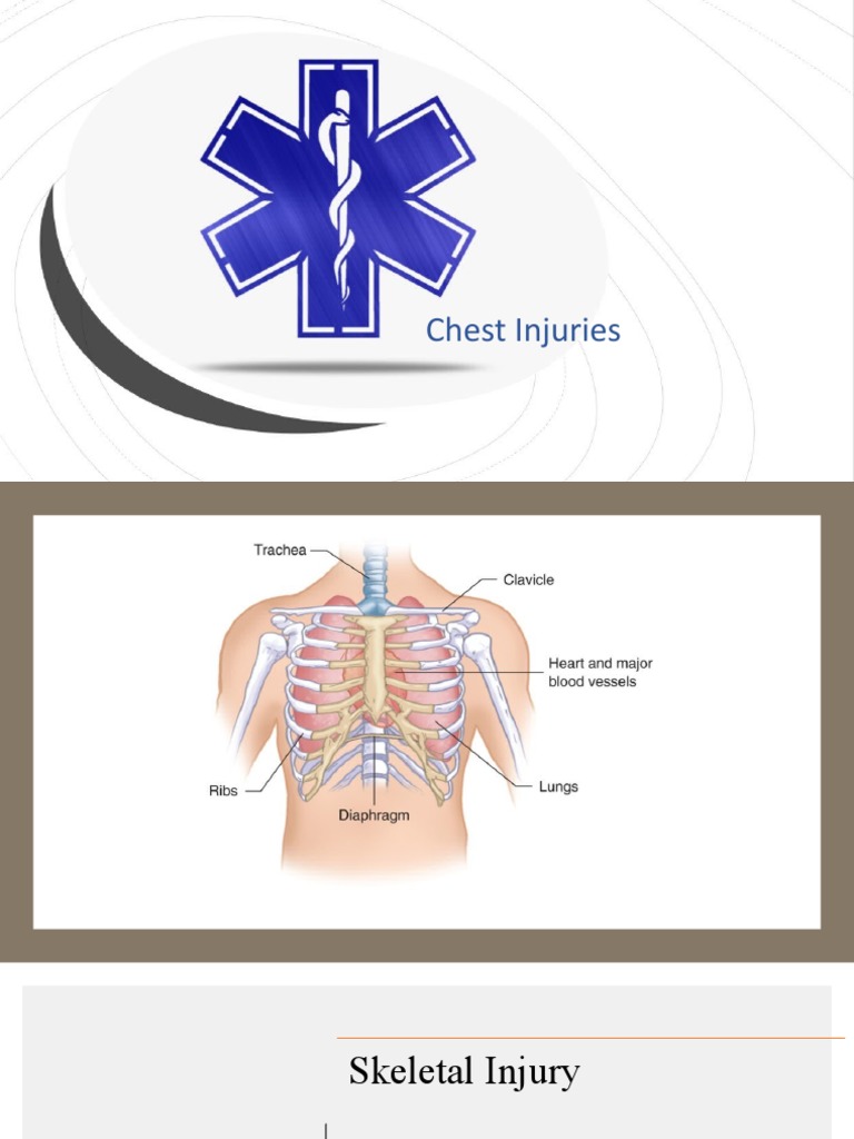 Chest Injuries Trauma Lab PDF
