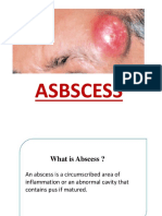 ABSCESS