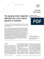 The Plunging Ranula: Diagnostic Difficulties and A Less Invasive Approach To Treatment