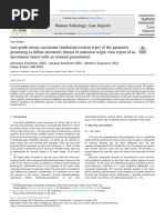 To Low-Grade - Serous - Carcinoma - Mullerianovarian - Type - o