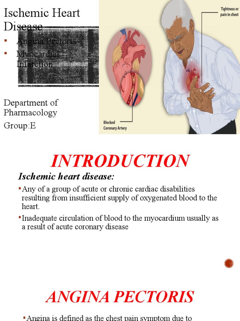 Overview of Ischemic Heart Disease | PDF | Myocardial Infarction ...