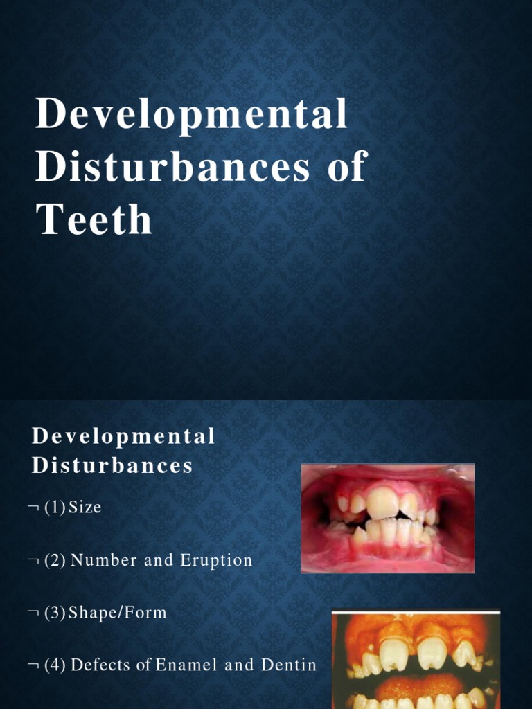 Developmental Disturbances | PDF | Language Arts & Discipline | Foreign ...