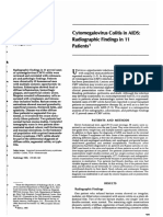 Colitis Por CMV