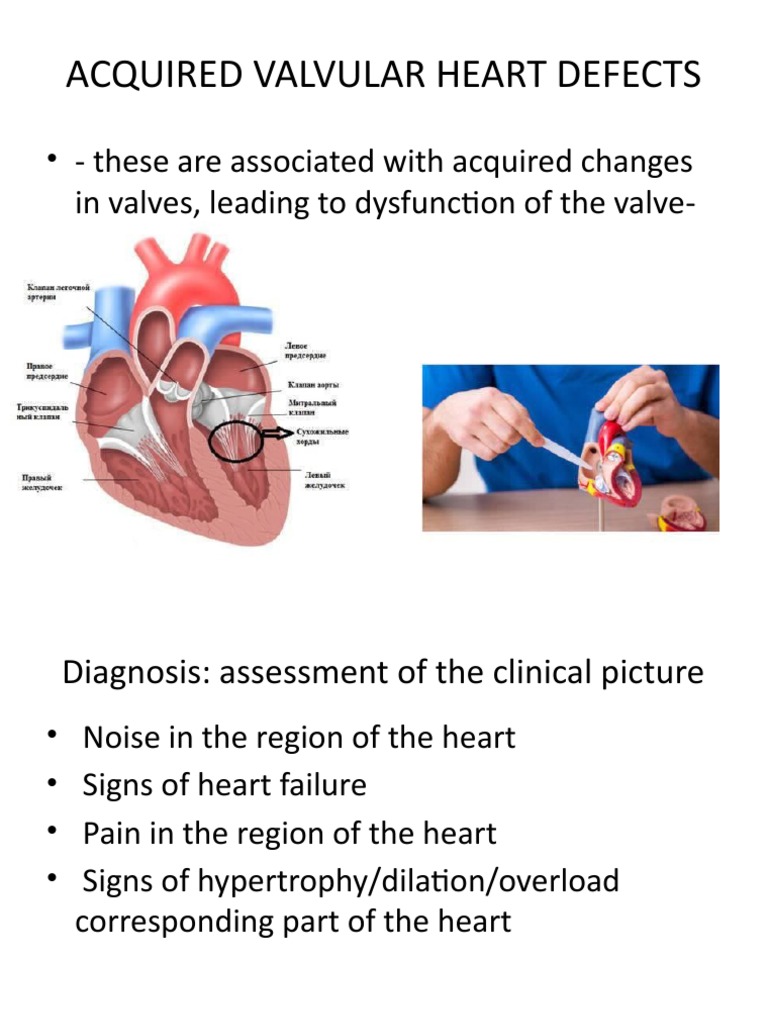 Heart Defect | PDF | Heart | Causes Of Death