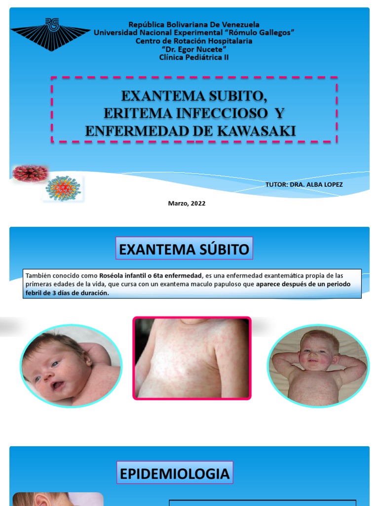 Exantema Subito Eritema Infeccioso Y Enf De Kawasaki Emily Descargar