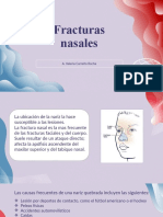 Fractura Nasal..