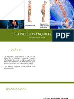 Espondilitis Anquilosante