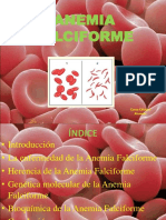 Anemia Falciforme