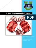 Enfermedad de Crohn