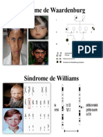 Sindromes de Waardenburg y Williams