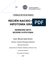 Hipotonia 