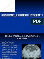 Hernia 3