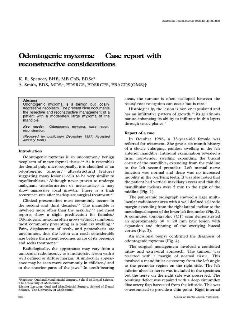 Australian Dental Journal 2008 Spencer Odontogenic Myxoma Case