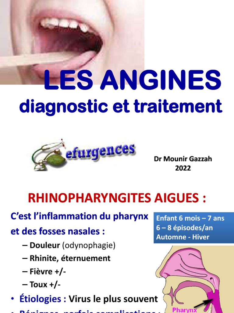 Angines | PDF | Sciences de la santé | Santé publique