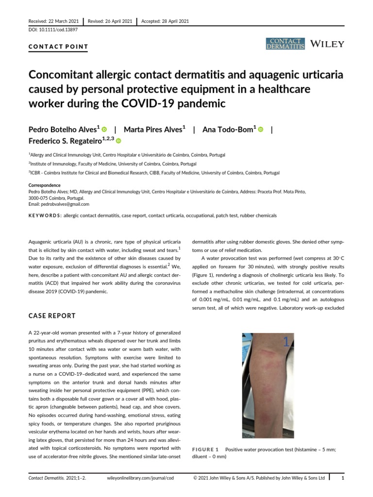 PPE25Case report of aquagenic urticaria PDF Allergy Dermatitis