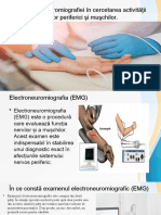 Electroneuromiografia