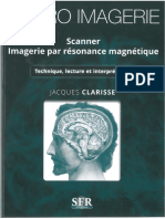 Neuro Imagerie Scanner Irm SFR