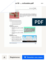Oclusion - Interferencias Oclusales PDF