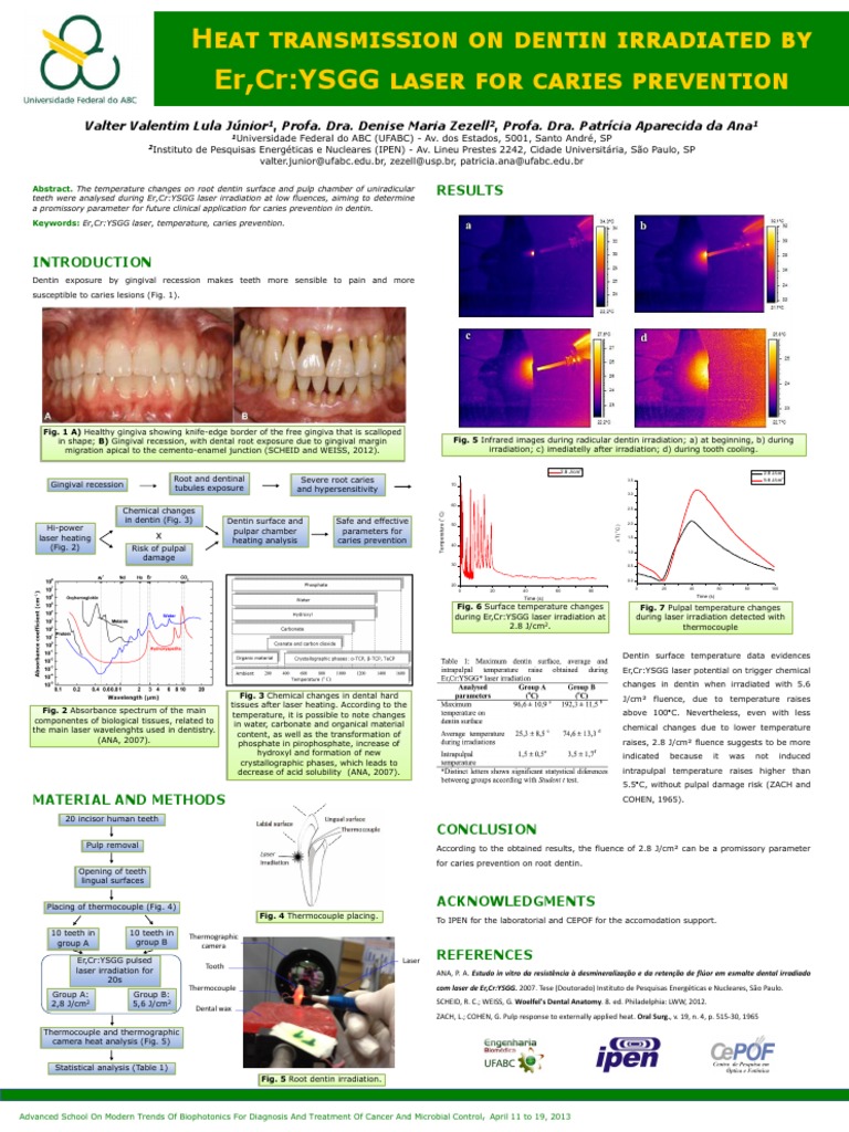 Root Carie Prevention by Laser PDF Dentin Tooth