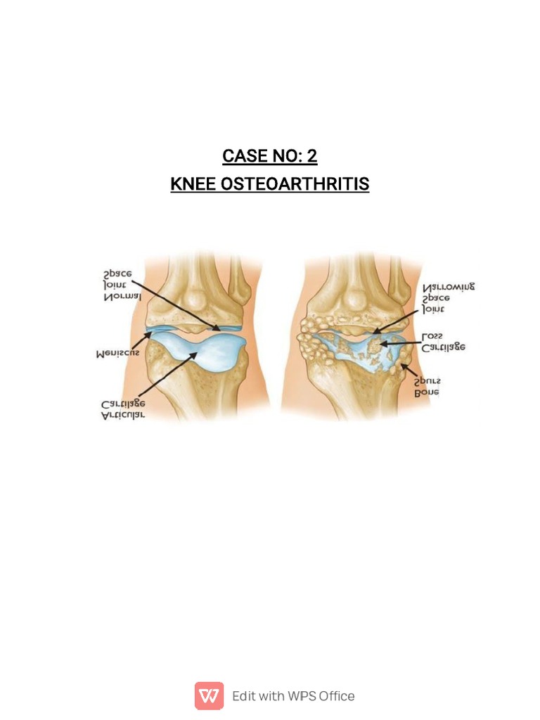 Knee PDF | PDF