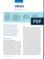 Paracentesis