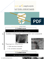 Complicatiile Extractiei Dentare