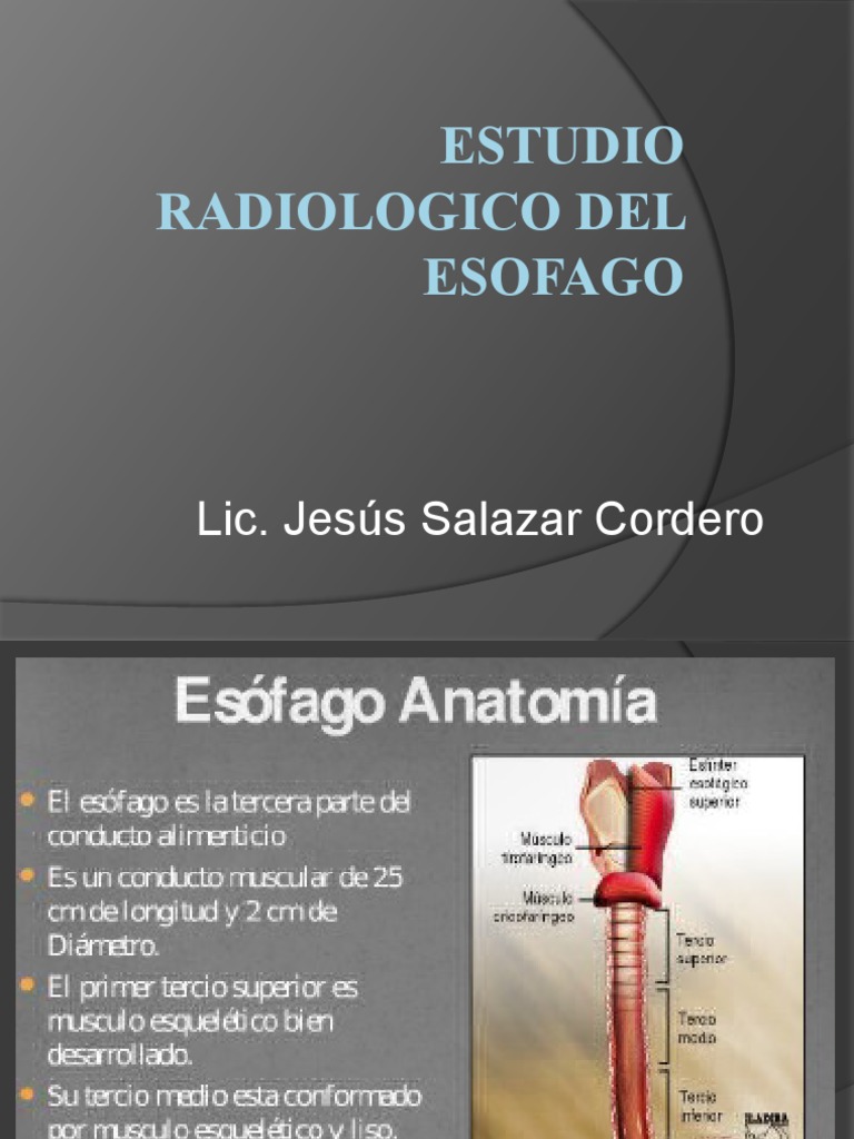 Estudio Radiológico del Esófago | PDF | La enfermedad por reflujo ...
