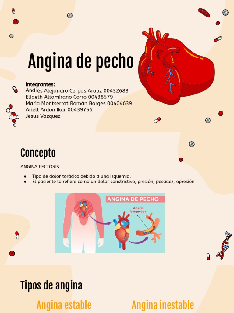 Angina de Pecho | PDF | Infarto de miocardio | Corazón
