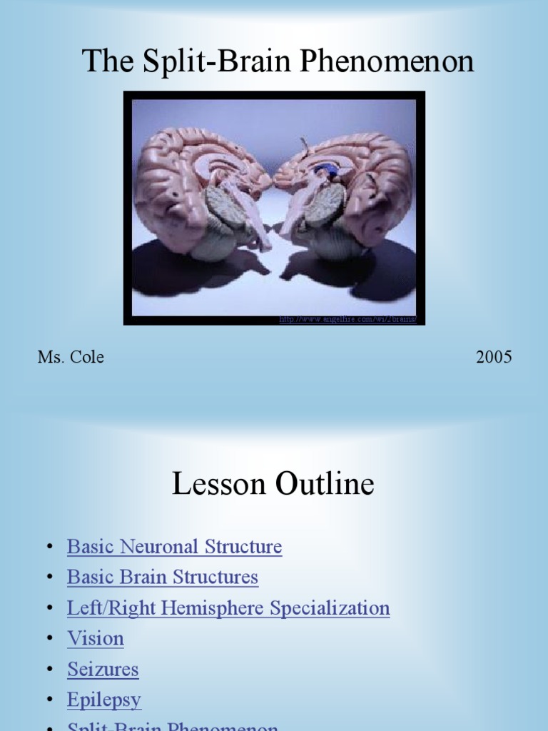 Split Brain | PDF | Epilepsy | Brain