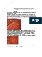 TECNICA QUIRURGICA Hemicolectomia Izquierda