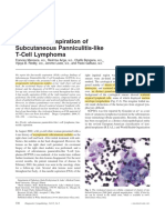 Fine-Needle Aspiration of Subcutaneous Panniculitis-Like T-Cell Lymphoma